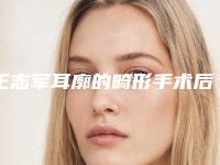 王志军耳廓的畸形手术后没效果怎么办